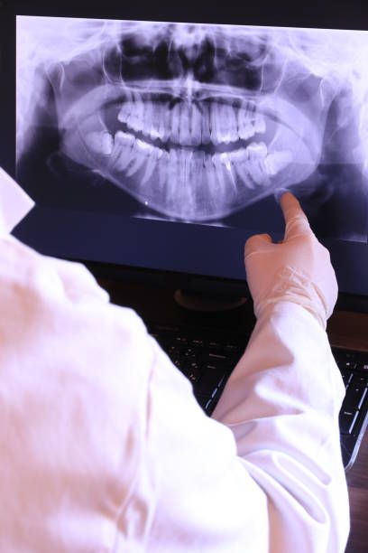 Best Emergency Tooth Extraction in Lordship, CT